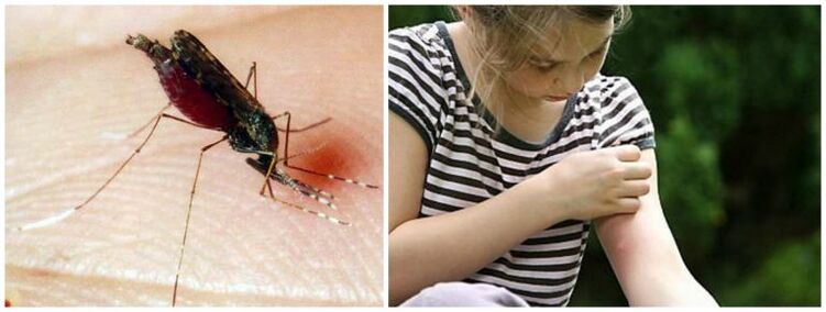 蚊虫叮咬后出现疼痛的肿块可能是心丝虫的症状