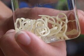 来自人体的寄生虫