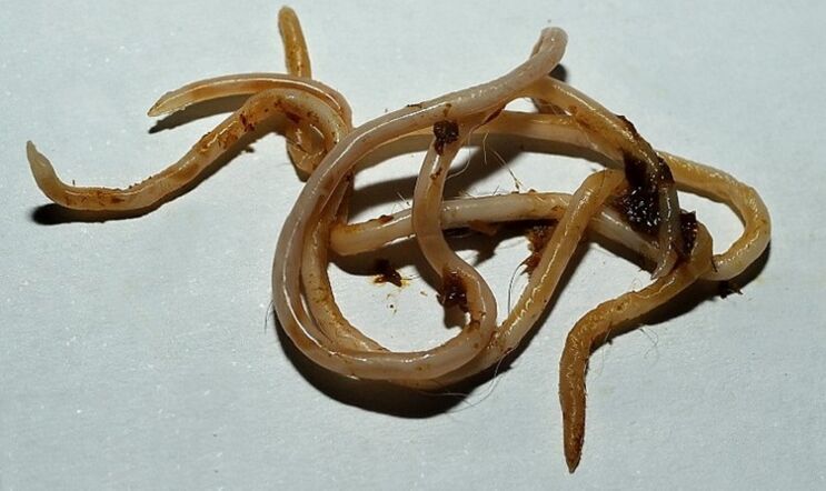 来自人体的弓蛔虫