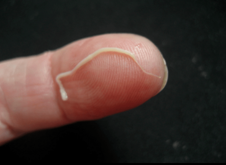 来自人体的蛔虫寄生虫